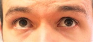 How To Stop Hot Pepper Burn On Hands & Skin - Pepper Geek