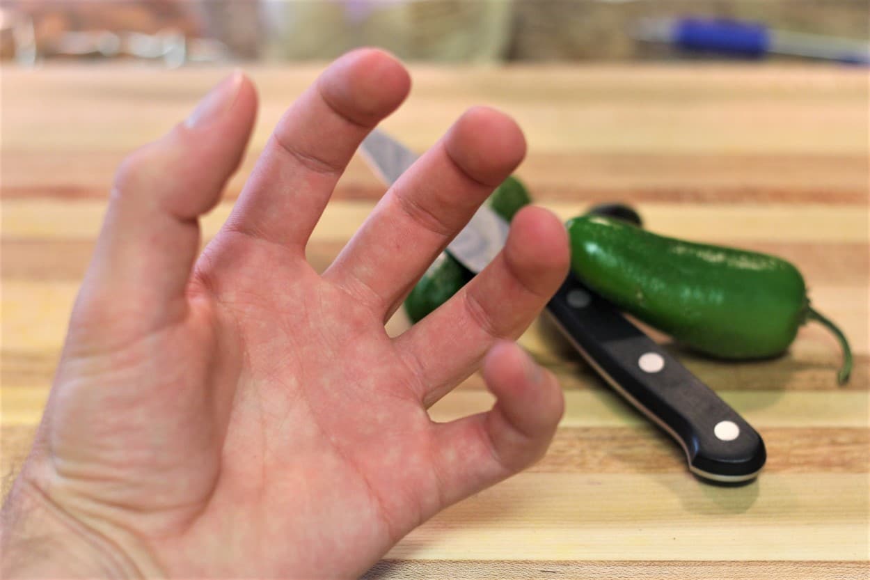 How To Stop Hot Chili Pepper Burn On Hands Skin Pepper Geek